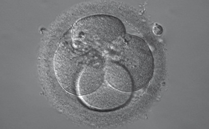 Embryo iHMC