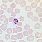 Plasmodium_Axio_Lab_A1